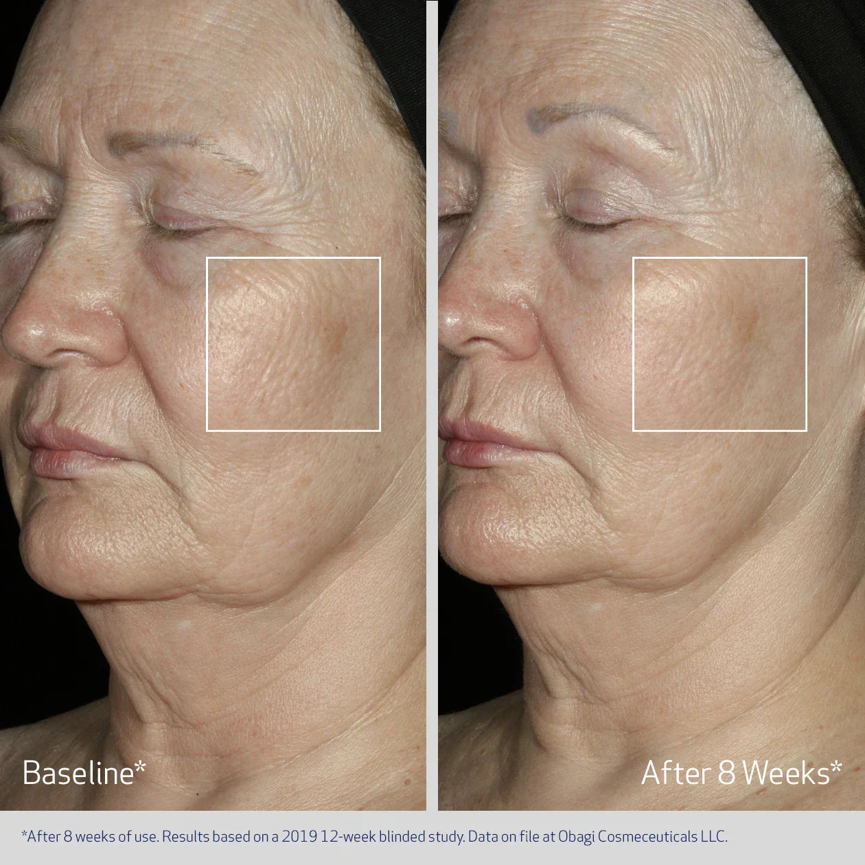 Obagi Medical Elastiderm Facial Serum